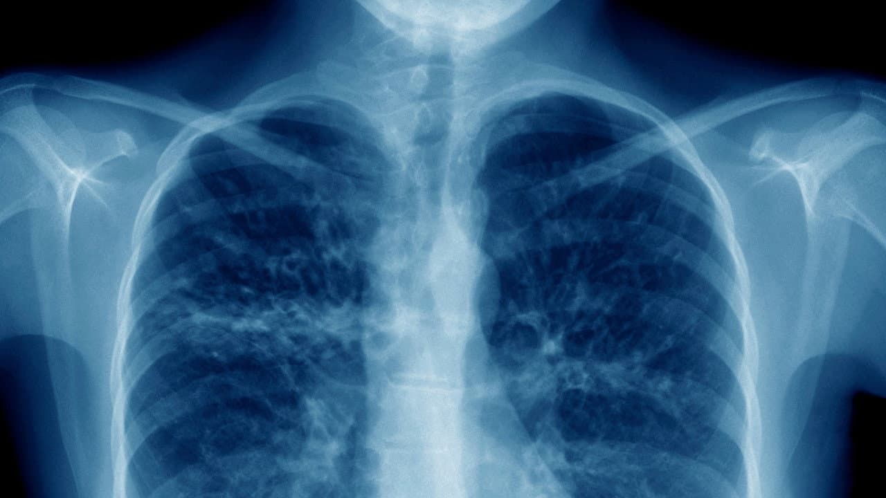 The Battle to Breathe still